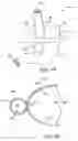 Fig. 02 - Obesity treatment tools and methods