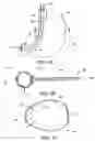 Fig. 04 - Obesity treatment tools and methods