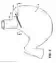 Fig. 06 - Methods and devices for maintaining a space occupying device in a relatively fixed location within a stomach