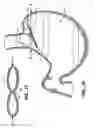 Fig. 07 - Methods and devices for maintaining a space occupying device in a relatively fixed location within a stomach