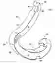 Fig. 01 - Non-snag polymer ligating clip
