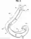 Fig. 04 - Non-snag polymer ligating clip
