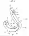 Fig. 08 - Non-snag polymer ligating clip