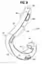 Fig. 09 - Non-snag polymer ligating clip