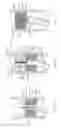 Fig. 09 - System and method for removal of material from a blood vessel using a small diameter catheter