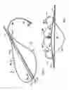 Fig. 03 - Apparatus and method for dissecting tissue layers