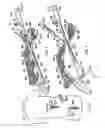 Fig. 04 - Apparatus and method for dissecting tissue layers