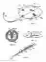 Fig. 10 - Apparatus and method for dissecting tissue layers