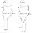 Fig. 02 - Systems and methods using expandable bodies to push apart adjacent vertebral bodies