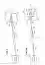 Fig. 06 - Systems and methods using expandable bodies to push apart adjacent vertebral bodies