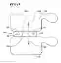 Fig. 07 - Systems and methods using expandable bodies to push apart adjacent vertebral bodies
