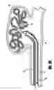 Fig. 07 - Embolic coil delivery system with spring wire release mechanism