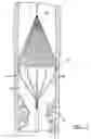 Fig. 06 - Foam embolic protection device