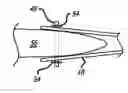 Fig. 01 - LAPAROSCOPIC SURGICAL CLAMP AND SUTURING METHODS