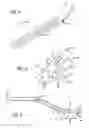 Fig. 03 - LAPAROSCOPIC SURGICAL CLAMP AND SUTURING METHODS