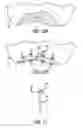 Fig. 05 - LAPAROSCOPIC SURGICAL CLAMP AND SUTURING METHODS