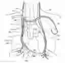 Fig. 01 - System and method to modulate phrenic nerve to prevent sleep apnea