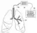Fig. 01 - DEVICES FOR MODIFICATION OF AIRWAYS BY TRANSFER OF ENERGY