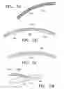 Fig. 08 - DEVICES FOR MODIFICATION OF AIRWAYS BY TRANSFER OF ENERGY