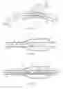 Fig. 04 - Bifurcation stent delivery system