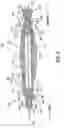Fig. 03 - Delivery system for a medical device