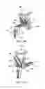 Fig. 23 - Delivery system for a medical device