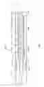 Fig. 09 - BALLOON CATHETER FOR MULTIPLE ADJUSTABLE STENT DEPLOYMENT