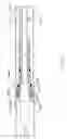 Fig. 06 - BALLOON CATHETER FOR MULTIPLE ADJUSTABLE STENT DEPLOYMENT