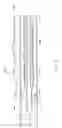 Fig. 09 - BALLOON CATHETER FOR MULTIPLE ADJUSTABLE STENT DEPLOYMENT