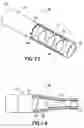 Fig. 09 - Stent/graft assembly
