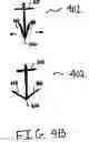 Fig. 06 - Methods, devices, and kits for treating mitral valve prolapse