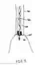 Fig. 07 - Methods, devices, and kits for treating mitral valve prolapse