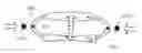 Fig. 01 - Accommodative intraocular lens