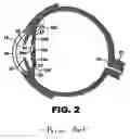 Fig. 03 - Accommodative intraocular lens