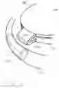 Fig. 06 - Accommodative intraocular lens