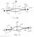 Fig. 08 - Accommodative intraocular lens