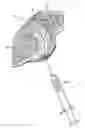 Fig. 01 - Facet joint implant and procedure