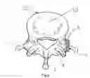 Fig. 05 - Transosseous spine core approach method implant and instrumentation