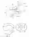 Fig. 05 - Posterior articular disc and method for implantation
