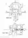 Fig. 02 - Intervertebral anulus and nucleus augmentation