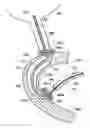 Fig. 01 - Retaining stent