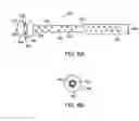 Fig. 07 - Retaining stent