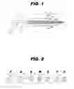 Fig. 02 - Fluted sleeve hip prosthesis for modular stem
