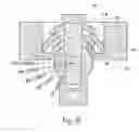 Fig. 04 - Adjustable bone prostheses and related methods related applications