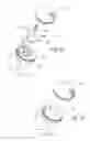 Fig. 22 - Adjustable bone prostheses and related methods related applications