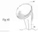 Fig. 35 - Adjustable bone prostheses and related methods related applications