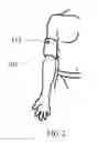 Fig. 03 - Protective glove with electrical signal interrupt feature