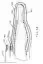 Fig. 06 - Protective glove with electrical signal interrupt feature