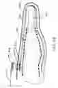 Fig. 06 - Medical electrode glove with partially insulating layer