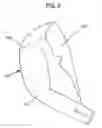 Fig. 03 - Reinforcement for garments